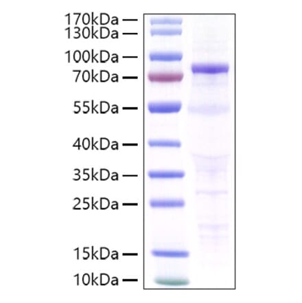 SDS-PAGE - Recombinant Human P-Cadherin Protein (C-terminal His Tag) (A331137) - Antibodies.com