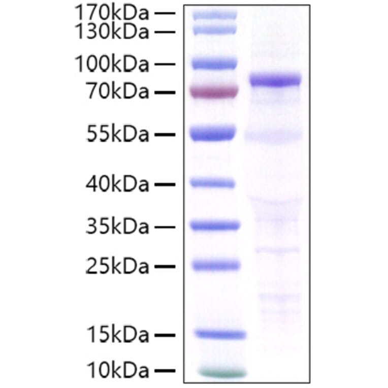 SDS-PAGE - Recombinant Human P-Cadherin Protein (C-terminal His Tag) (A331137) - Antibodies.com