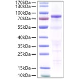 SDS-PAGE - Recombinant Human P-Cadherin Protein (C-terminal His Tag) (A331137) - Antibodies.com