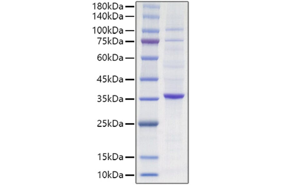 SDS-PAGE - Recombinant Human PCNA Protein (N-terminal HA Tag) (A331138) - Antibodies.com