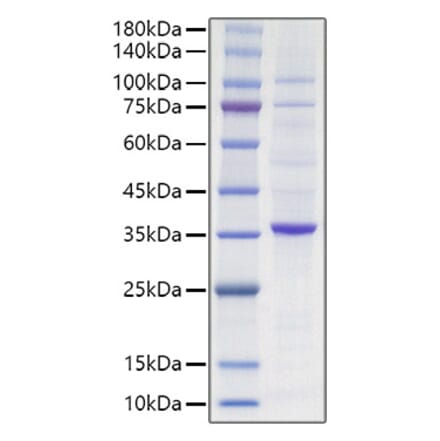 SDS-PAGE - Recombinant Human PCNA Protein (N-terminal HA Tag) (A331138) - Antibodies.com
