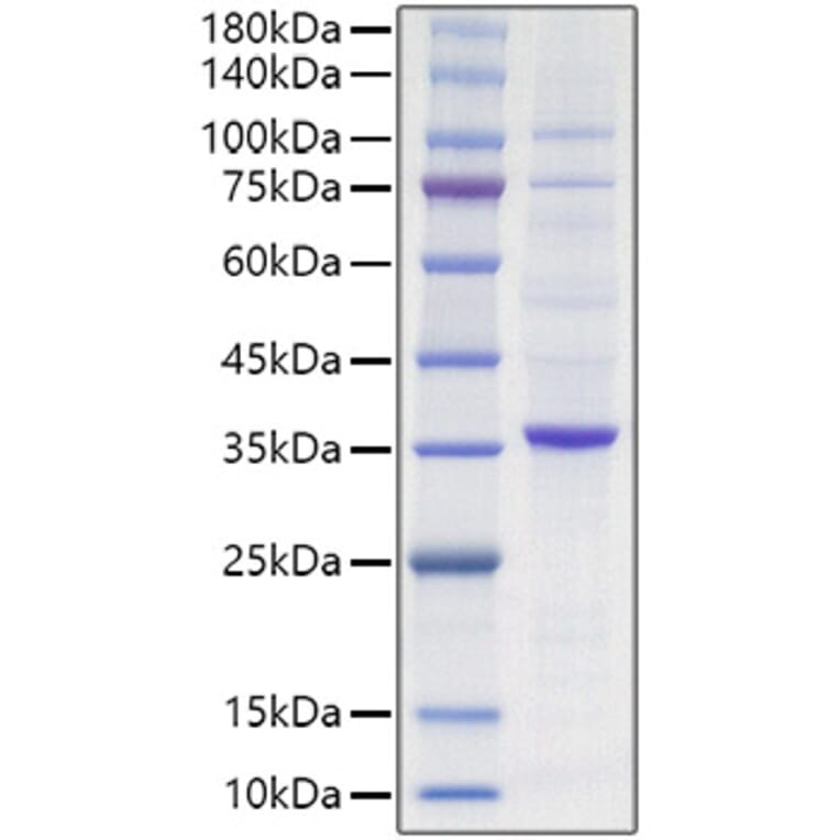 SDS-PAGE - Recombinant Human PCNA Protein (N-terminal HA Tag) (A331138) - Antibodies.com