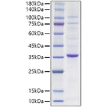 SDS-PAGE - Recombinant Human PCNA Protein (N-terminal HA Tag) (A331138) - Antibodies.com