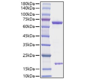 SDS-PAGE - Recombinant Rat PCSK9 Protein (C-terminal His Tag) (A331139) - Antibodies.com