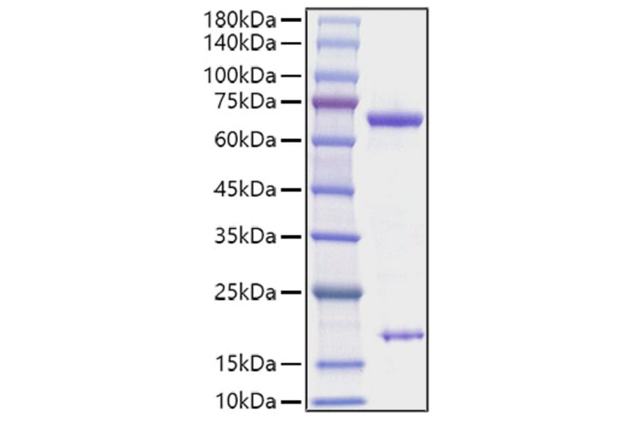 SDS-PAGE - Recombinant Rat PCSK9 Protein (C-terminal His Tag) (A331139) - Antibodies.com