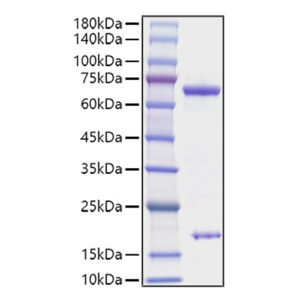 SDS-PAGE - Recombinant Rat PCSK9 Protein (C-terminal His Tag) (A331139) - Antibodies.com