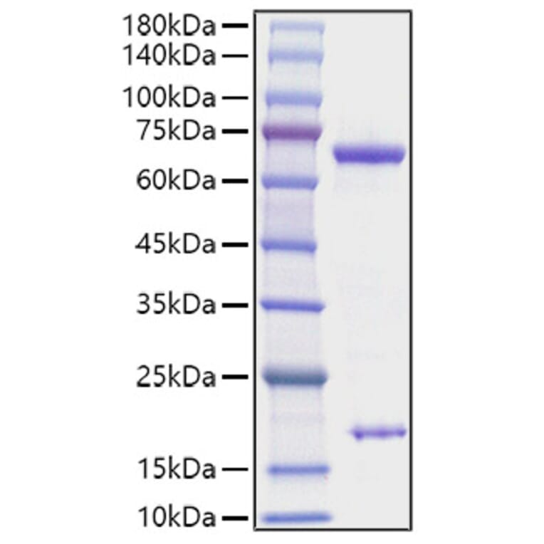 SDS-PAGE - Recombinant Rat PCSK9 Protein (C-terminal His Tag) (A331139) - Antibodies.com