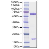 SDS-PAGE - Recombinant Rat PCSK9 Protein (C-terminal His Tag) (A331139) - Antibodies.com
