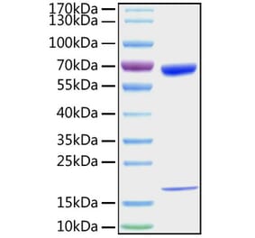 SDS-PAGE - Recombinant Mouse PCSK9 Protein (C-terminal His Tag) (A331140) - Antibodies.com
