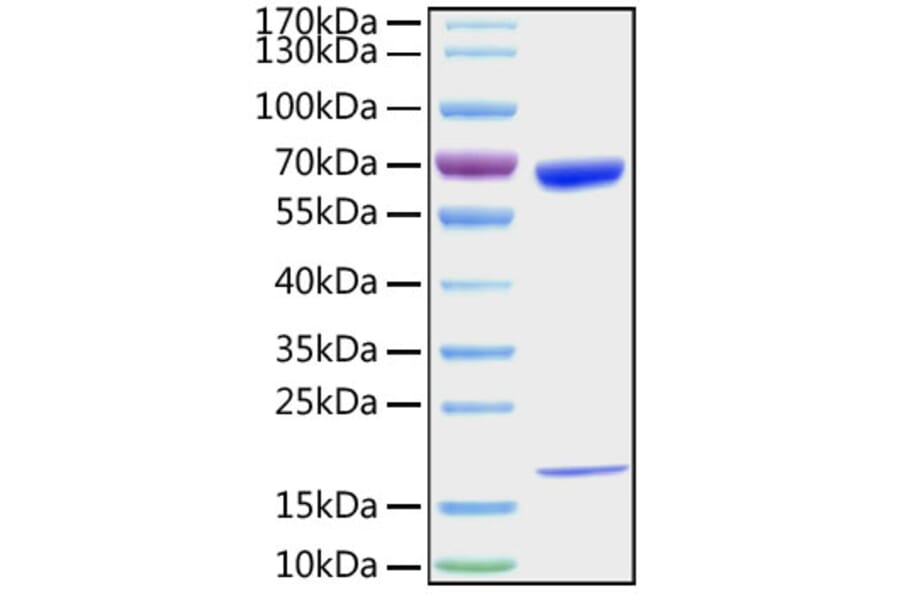 SDS-PAGE - Recombinant Mouse PCSK9 Protein (C-terminal His Tag) (A331140) - Antibodies.com