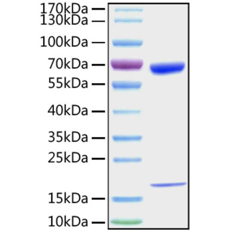 SDS-PAGE - Recombinant Mouse PCSK9 Protein (C-terminal His Tag) (A331140) - Antibodies.com