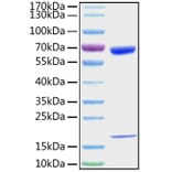 SDS-PAGE - Recombinant Mouse PCSK9 Protein (C-terminal His Tag) (A331140) - Antibodies.com