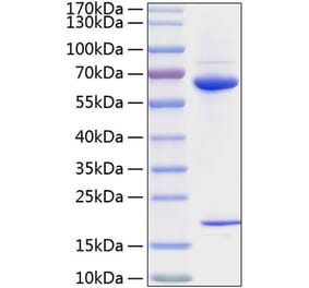 SDS-PAGE - Recombinant Human PCSK9 Protein (C-terminal His Tag) (A331141) - Antibodies.com