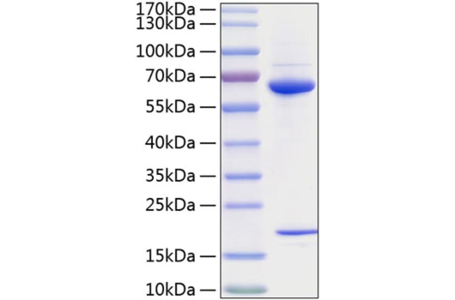SDS-PAGE - Recombinant Human PCSK9 Protein (C-terminal His Tag) (A331141) - Antibodies.com