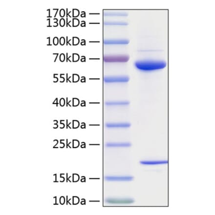SDS-PAGE - Recombinant Human PCSK9 Protein (C-terminal His Tag) (A331141) - Antibodies.com