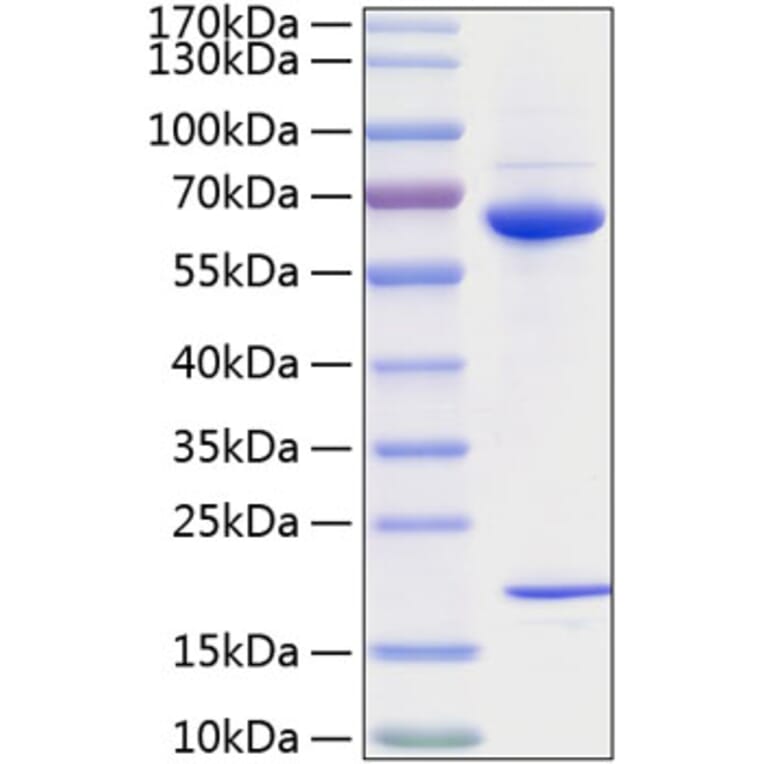 SDS-PAGE - Recombinant Human PCSK9 Protein (C-terminal His Tag) (A331141) - Antibodies.com