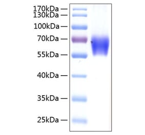 SDS-PAGE - Recombinant Human PD1 Protein (C-terminal Human Fc and His Tag) (A331142) - Antibodies.com