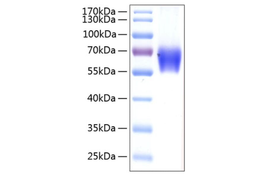 SDS-PAGE - Recombinant Human PD1 Protein (C-terminal Human Fc and His Tag) (A331142) - Antibodies.com