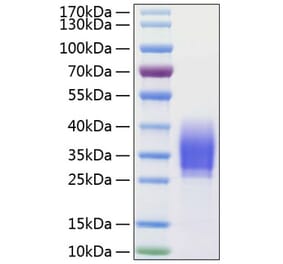 SDS-PAGE - Recombinant Human PD1 Protein (C-terminal His Tag) (A331143) - Antibodies.com