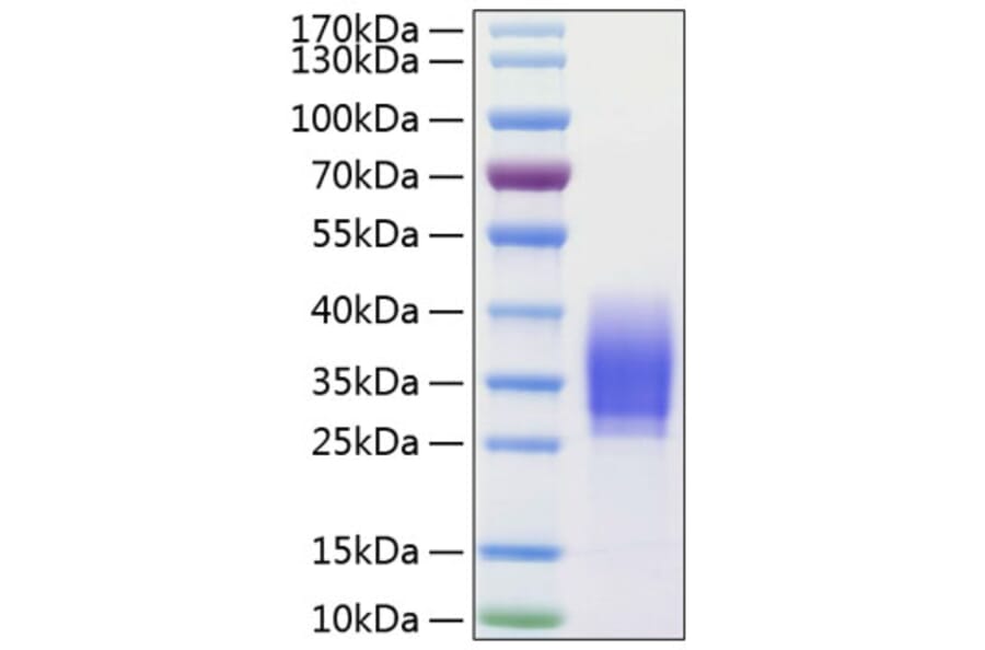 SDS-PAGE - Recombinant Human PD1 Protein (C-terminal His Tag) (A331143) - Antibodies.com