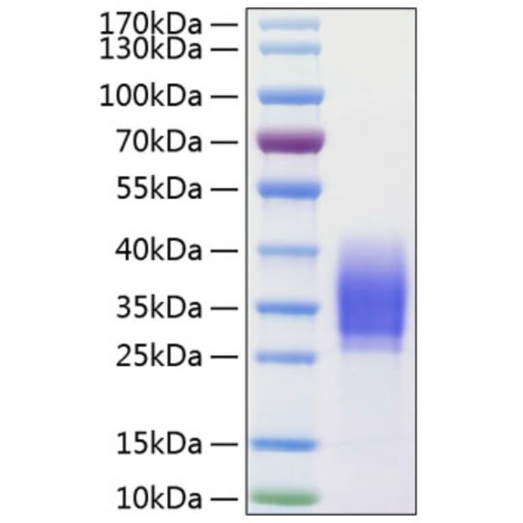 SDS-PAGE - Recombinant Human PD1 Protein (C-terminal His Tag) (A331143) - Antibodies.com