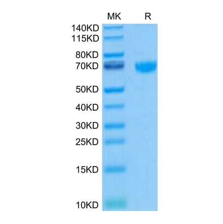 Tris-Bis PAGE - Recombinant Human PD1 Protein (Biotin) (C-terminal Human Fc and Avi Tag) (A331144) - Antibodies.com