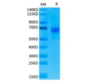 Tris-Bis PAGE - Recombinant Human PD1 Protein (C-terminal Human Fc Tag) (A331146) - Antibodies.com