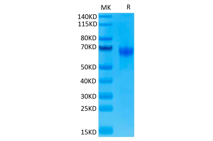 Tris-Bis PAGE - Recombinant Human PD1 Protein (C-terminal Human Fc Tag) (A331146) - Antibodies.com