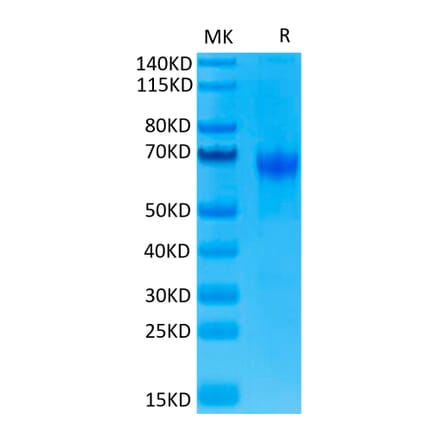 Tris-Bis PAGE - Recombinant Human PD1 Protein (C-terminal Human Fc Tag) (A331146) - Antibodies.com