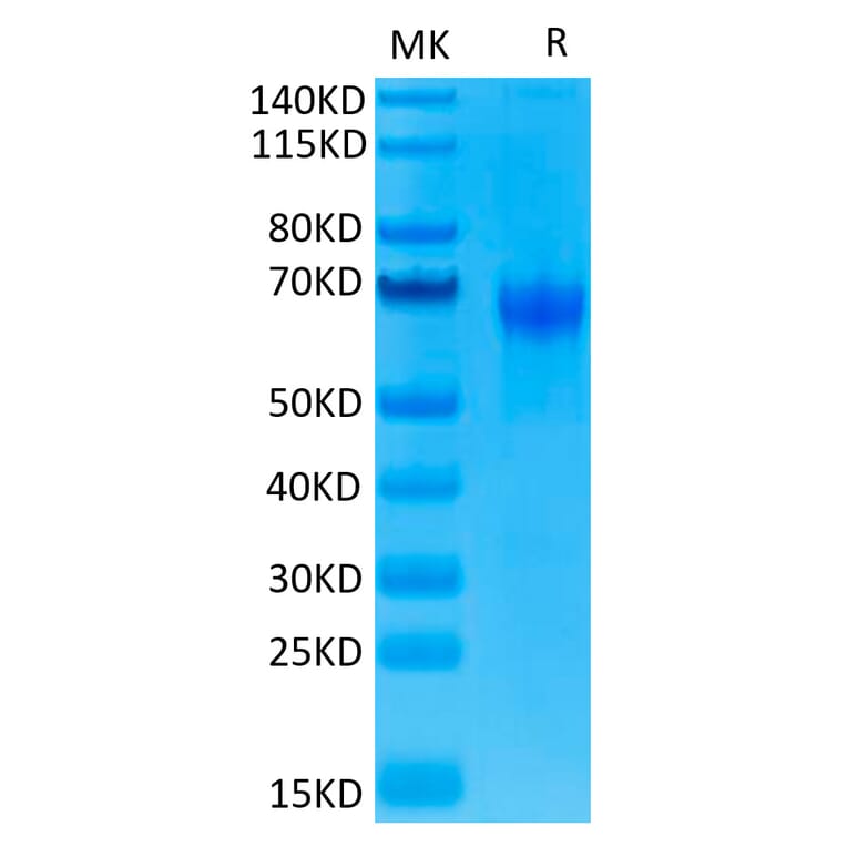Tris-Bis PAGE - Recombinant Human PD1 Protein (C-terminal Human Fc Tag) (A331146) - Antibodies.com