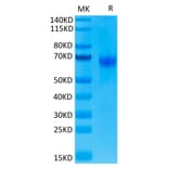 Tris-Bis PAGE - Recombinant Human PD1 Protein (C-terminal Human Fc Tag) (A331146) - Antibodies.com