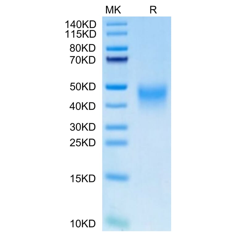 Tris-Bis PAGE - Recombinant Human PD1 Protein (C-terminal His Tag) (A331147) - Antibodies.com