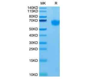 Tris-Bis PAGE - Recombinant Human PD1 Protein (C-terminal Mouse Fc Tag) (A331148) - Antibodies.com