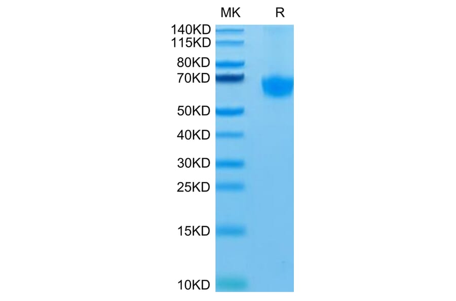 Tris-Bis PAGE - Recombinant Human PD1 Protein (C-terminal Mouse Fc Tag) (A331148) - Antibodies.com