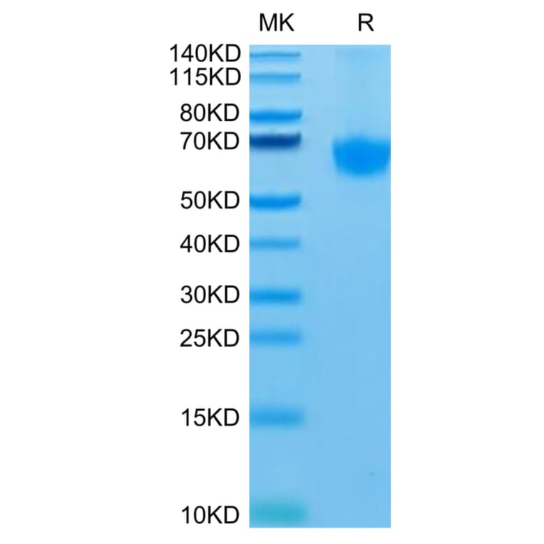 Tris-Bis PAGE - Recombinant Human PD1 Protein (C-terminal Mouse Fc Tag) (A331148) - Antibodies.com