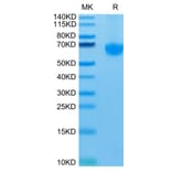 Tris-Bis PAGE - Recombinant Human PD1 Protein (C-terminal Mouse Fc Tag) (A331148) - Antibodies.com