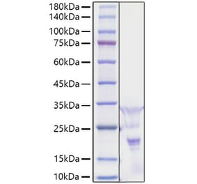 SDS-PAGE - Recombinant Human PDGF AA Protein (A331149) - Antibodies.com
