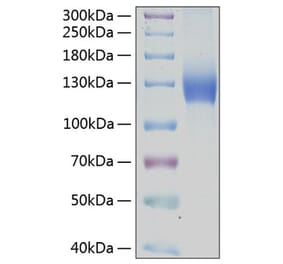 SDS-PAGE - Recombinant Human PDGFR alpha Protein (C-terminal Human Fc and His Tag) (A331151) - Antibodies.com