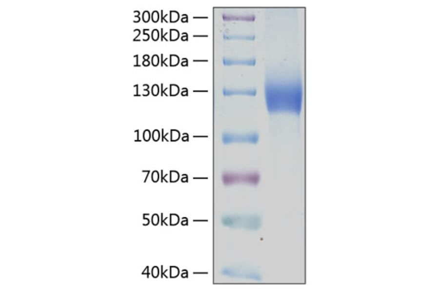 SDS-PAGE - Recombinant Human PDGFR alpha Protein (C-terminal Human Fc and His Tag) (A331151) - Antibodies.com