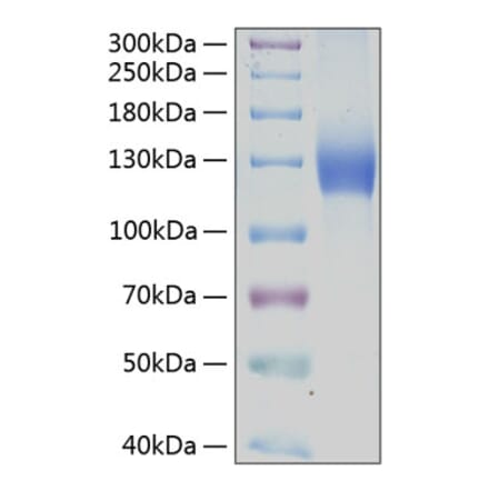 SDS-PAGE - Recombinant Human PDGFR alpha Protein (C-terminal Human Fc and His Tag) (A331151) - Antibodies.com