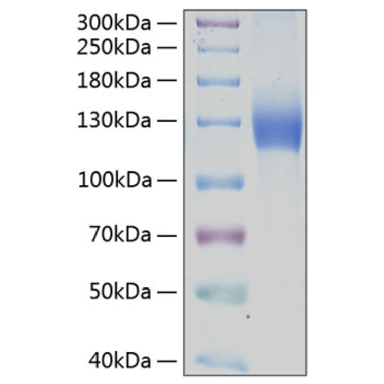 SDS-PAGE - Recombinant Human PDGFR alpha Protein (C-terminal Human Fc and His Tag) (A331151) - Antibodies.com