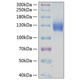 SDS-PAGE - Recombinant Human PDGFR alpha Protein (C-terminal Human Fc and His Tag) (A331151) - Antibodies.com