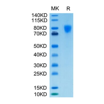 Tris-Bis PAGE - Recombinant Human PDGFR alpha Protein (Biotin) (C-terminal His and Avi Tag) (A331152) - Antibodies.com