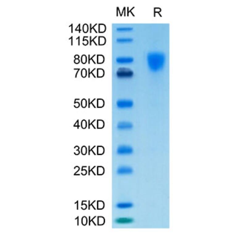 Tris-Bis PAGE - Recombinant Human PDGFR alpha Protein (Biotin) (C-terminal His and Avi Tag) (A331152) - Antibodies.com