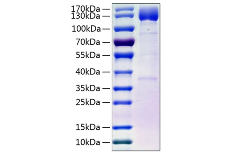 SDS-PAGE - Recombinant Human PDGFR beta Protein (C-terminal Human Fc and His Tag) (A331153) - Antibodies.com