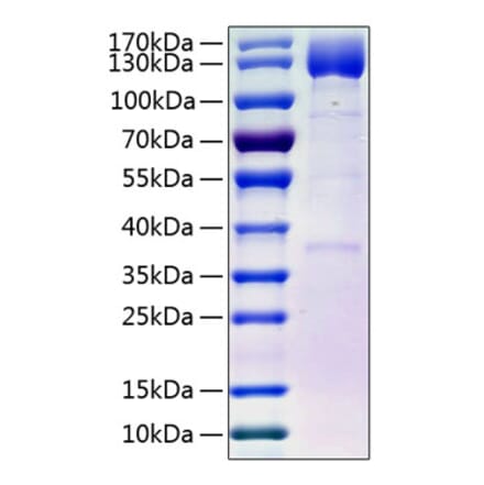 SDS-PAGE - Recombinant Human PDGFR beta Protein (C-terminal Human Fc and His Tag) (A331153) - Antibodies.com