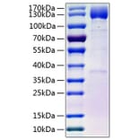 SDS-PAGE - Recombinant Human PDGFR beta Protein (C-terminal Human Fc and His Tag) (A331153) - Antibodies.com