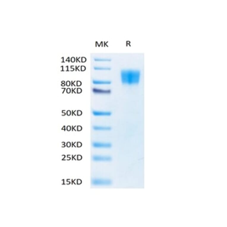 Tris-Bis PAGE - Recombinant Human PDGFR beta Protein (Biotin) (C-terminal His and Avi Tag) (A331154) - Antibodies.com