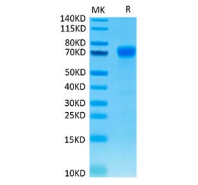 Tris-Bis PAGE - Recombinant Human PD-L1 Protein (C-terminal Mouse Fc Tag) (A331155) - Antibodies.com