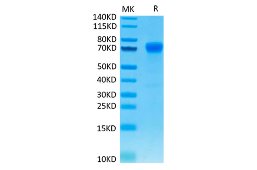 Tris-Bis PAGE - Recombinant Human PD-L1 Protein (C-terminal Mouse Fc Tag) (A331155) - Antibodies.com